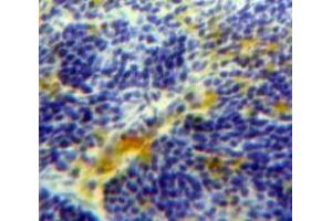 Used in DAB staining on fromalin fixed paraffin-embedded Spleen tissue (FCN1 Antikörper  (AA 45-249))