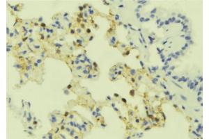 ABIN6273909 at 1/100 staining Mouse lung tissue by IHC-P. (SSTR4 Antikörper  (C-Term))