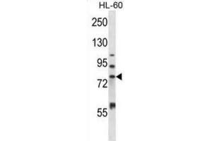 Western Blotting (WB) image for anti-Matrix Metallopeptidase 15 (Membrane-inserted) (MMP15) antibody (ABIN2997513) (MMP15 Antikörper)