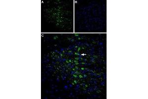 Immunohistochemistry (IHC) image for anti-Calcium Channel, Voltage-Dependent, gamma Subunit 6 (CACNG6) (AA 87-100), (Extracellular) antibody (ABIN7042994)