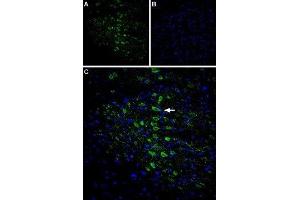 Expression of CaVγ6 (CACNG6) in rat brain - Immunohistochemical staining of rat cingulate cortex using Anti-CACNG6 (extracellular) Antibody (ABIN7042994, ABIN7044055 and ABIN7044056), (1:400). (CACNG6 Antikörper  (1st Extracellular Loop))