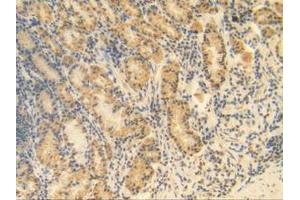 IHC-P analysis of Human Stomach Tissue, with DAB staining. (MGP Antikörper  (AA 1-103))