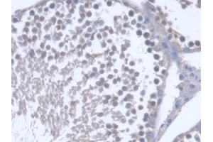 Immunohistochemistry (IHC) image for anti-Osteosarcoma Amplified 9, Endoplasmic Reticulum Lectin (OS9) (AA 465-666) antibody (ABIN5014064)