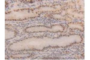 IHC-P analysis of Human Stomach Tissue, with DAB staining. (PCNA Antikörper  (AA 6-261))
