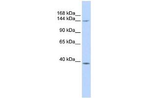 SMC4 antibody used at 1 ug/ml to detect target protein. (SMC4 Antikörper  (Middle Region))