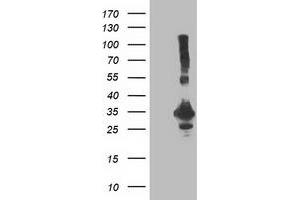 Western Blotting (WB) image for anti-Phenylethanolamine N-Methyltransferase (PNMT) antibody (ABIN1500308) (PNMT Antikörper)
