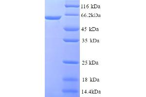 SDS-PAGE (SDS) image for Chromosome 1 Open Reading Frame 106 (C1ORF106) (AA 1-578), (full length) protein (His tag) (ABIN5714366)