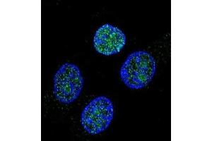 Immunofluorescence (IF) image for anti-Vitamin K-dependent protein C (PROC) antibody (ABIN2997388) (PROC Antikörper)