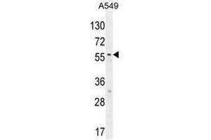 SYNCI Antibody (N-term) western blot analysis in A549 cell line lysates (35µg/lane). (Syncoilin Antikörper  (N-Term))
