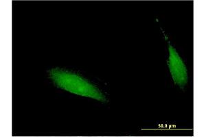 Immunofluorescence of monoclonal antibody to CENPV on HeLa cell. (CENPV Antikörper  (AA 173-272))