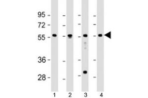 Western blot testing of human 1) fetal liver, 2) lung, 3) Jurkat and 4) K562 cell lysate with EFS antibody at 1:2000. (EFS Antikörper  (AA 367-399))