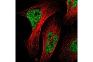 Immunofluorescent staining of U-2 OS with NACC1 polyclonal antibody  (Green) shows positivity in nucleus but excluded from the nucleoli. (NAC1 Antikörper)