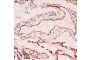 Immunohistochemistry (IHC) image for anti-Collagen, Type IV, alpha 1 (COL4A1) (AA 1445-1669) antibody (ABIN3042755)