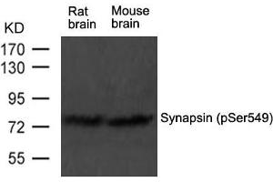 Western blot analysis of extract from rat brain and mouse brain tissue using Synapsin(phospho-Ser549) Antibody using (SYN1 Antikörper  (pSer549))