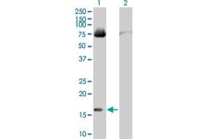 Lane 1: FABP4 transfected lysate ( 14. (FABP4 293T Cell Transient Overexpression Lysate(Denatured))