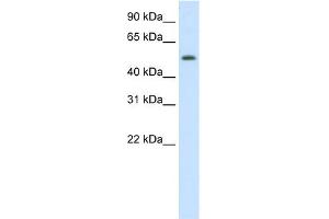 WB Suggested Anti-DIDO1 Antibody Titration:  0. (DIDO1 Antikörper  (N-Term))