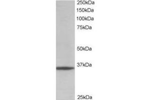 Image no. 1 for anti-Glyceraldehyde-3-Phosphate Dehydrogenase (GAPDH) (C-Term) antibody (ABIN374435) (GAPDH Antikörper  (C-Term))