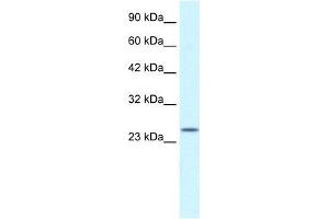 Human Jurkat; WB Suggested Anti-ZA20D3 Antibody Titration: 2. (ZFAND6 Antikörper  (Middle Region))