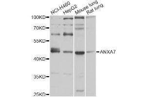 Western blot analysis of extracts of various cell lines, using ANXA7 antibody (ABIN5971923) at 1/1000 dilution. (Annexin VII Antikörper)