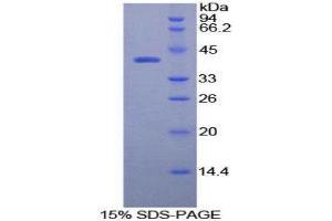 SDS-PAGE (SDS) image for Osteocalcin (BGLAP) (AA 11-98) protein (His tag,GST tag) (ABIN1879888)