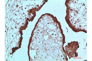Immunohistochemical analysis of paraffin-embedded Human Placenta Tissue using HP-1 α Mouse mAb diluted at 1:200 (CBX5 Antikörper)