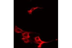 ABIN6267547 staining HeLa by IF/ICC. (VASP Antikörper  (pSer239))
