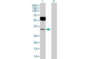 Western Blot analysis of UCHL1 expression in transfected 293T cell line by UCHL1 MaxPab polyclonal antibody. (UCHL1 Antikörper  (AA 1-223))