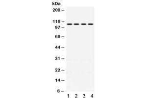 Western blot testing of 1) rat kidney, 2) mouse kidney, 3) human HeLa and 4) human A431 lysate with MR antibody.