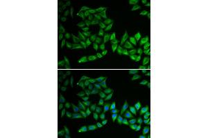 Immunofluorescence analysis of U2OS cell using TPMT antibody. (TPMT Antikörper)