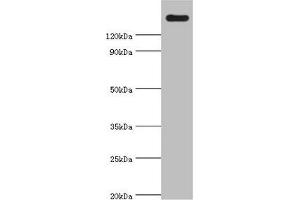 Western blot All lanes: CARD11 antibody at 4 μg/mL + K562 whole cell lysate Secondary Goat polyclonal to rabbit IgG at 1/10000 dilution Predicted band size: 133 kDa Observed band size: 133 kDa (CARD11 Antikörper  (AA 985-1154))