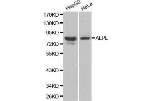 Western blot analysis of HepG2 cell and Hela cell lysate using ALPL antibody. (ALPL Antikörper  (AA 20-270))