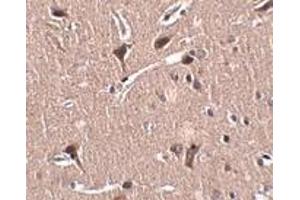 Immunohistochemistry (IHC) image for anti-Zinc Finger Protein 667 (ZNF667) (N-Term) antibody (ABIN1031458) (ZNF667 Antikörper  (N-Term))