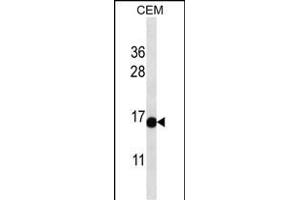 ATAD4 Antibody (C-term) (ABIN657177 and ABIN2837907) western blot analysis in CEM cell line lysates (35 μg/lane). (PRR15L Antikörper  (C-Term))