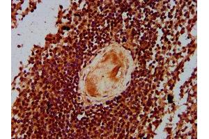 Immunohistochemistry (IHC) image for anti-Core-binding Factor, Runt Domain, alpha Subunit 2, Translocated To, 3 (CBFA2T3) (AA 39-159) antibody (ABIN7165194)