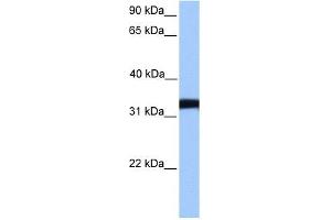 LDHC antibody used at 1 ug/ml to detect target protein. (Lactate Dehydrogenase C Antikörper  (Middle Region))