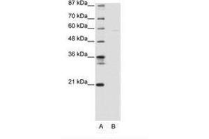 Image no. 1 for anti-SWI/SNF Related, Matrix Associated, Actin Dependent Regulator of Chromatin, Subfamily D, Member 3 (SMARCD3) (AA 139-188) antibody (ABIN6736140) (SMARCD3 Antikörper  (AA 139-188))