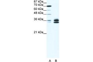 WB Suggested Anti-RELA Antibody Titration:  1. (NF-kB p65 Antikörper  (N-Term))