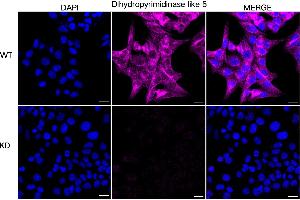 anti-Dihydropyrimidinase-Like 5 (DPYSL5) antibody