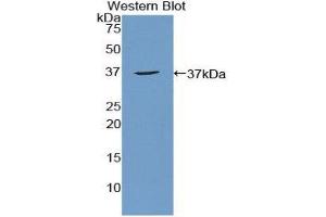 Western Blotting (WB) image for anti-Apoptosis Antagonizing Transcription Factor (AATF) (AA 237-523) antibody (ABIN1857853) (AATF Antikörper  (AA 237-523))