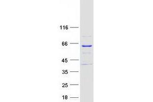 Western Blotting (WB) image for Meiosis 1 Associated Protein (M1AP) protein (Myc-DYKDDDDK Tag) (ABIN2715503)