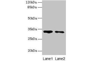 Western blot All lanes: SLA antibody at 5 μg/mL Lane 1: 293T whole cell lysate Lane 2: A431 whole cell lysate Secondary Goat polyclonal to rabbit IgG at 1/10000 dilution Predicted band size: 32, 20, 34, 28, 36 kDa Observed band size: 32 kDa