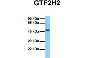 Host:  Rabbit  Target Name:  GTF2H2  Sample Tissue:  Human 293T  Antibody Dilution:  1.
