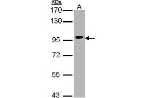 Western Blotting (WB) image for anti-Villin 1 (VIL1) (N-Term) antibody (ABIN2856719)