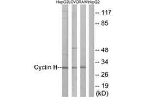 Western blot analysis of extracts from HepG2/LOVO/RAW264. (Cyclin H Antikörper  (AA 274-323))