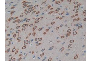 DAB staining on IHC-P; Samples: Rat Brain Tissue (Cx40/GJA5 Antikörper  (AA 50-303))