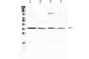 Western blot analysis of Annexin IV using anti- Annexin IV antibody . (Annexin IV Antikörper  (Middle Region))
