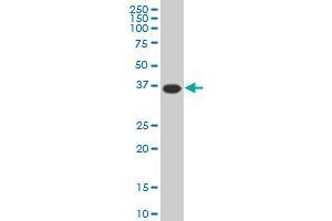 MEOX2 monoclonal antibody (M02), clone 5A6 Western Blot analysis of MEOX2 expression in HeLa . (MEOX2 Antikörper  (AA 1-303))