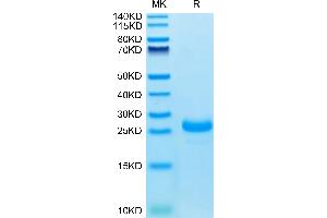 SDS-PAGE (SDS) image for Interleukin 33 (IL33) (AA 109-270) protein (His tag) (ABIN7274937)