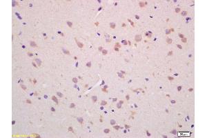 Formalin-fixed and paraffin embedded rat brain labeled with Rabbit Anti CHAC1 Polyclonal Antibody, Unconjugated (ABIN872557) at 1:200 followed by conjugation to the secondary antibody and DAB staining (CHAC1 Antikörper  (AA 131-222))