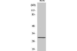 Western Blotting (WB) image for anti-Homeobox B5 (HOXB5) (Internal Region) antibody (ABIN3185074)